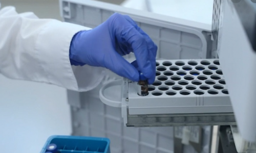 Công nghệ phát hiện virus SARS-CoV-2 trong 5 phút