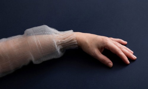 Sợi vải kỹ thuật số: Giải pháp y tế thông minh mới cho tương lai