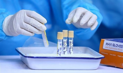 Sáng 9/7: Thêm 425 ca mắc COVID-19