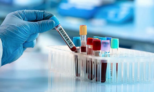 Phát minh mới cho phép dự đoán nguy cơ mắc COVID-19 nặng ở người