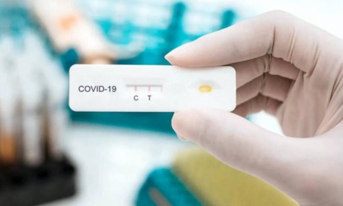 Bộ Y tế khẩn cấp yêu cầu doanh nghiệp báo cáo việc cung ứng và giá bán test xét nghiệm COVID-19