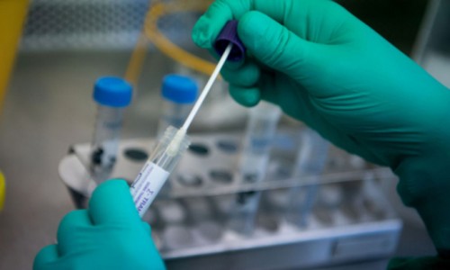 Công ty Đức Minh nhập bộ test Covid giá từ 96.000 - 150.000 đồng, bán giá gấp 3