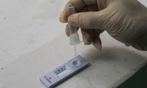 Cảnh báo: Kit test nhanh COVID có hoá chất nguy hiểm, người dân cần thận trọng