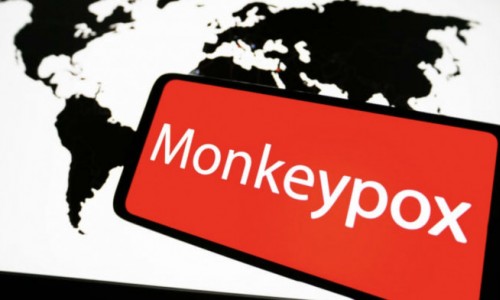Nóng: WHO ban bố tình trạng y tế khẩn cấp toàn cầu vì bệnh đậu mùa khỉ