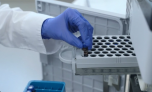 Công nghệ phát hiện virus SARS-CoV-2 trong 5 phút