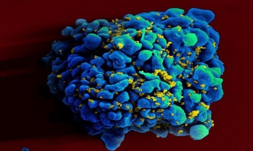 Thử nghiệm vaccine mRNA ngừa HIV cho kết quả tích cực trên động vật