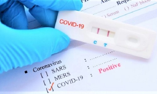 Hà Nội được phép dùng kết quả test nhanh xác định F0